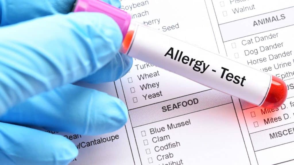 Allergy Testing at ROC. What to expect from a consultation