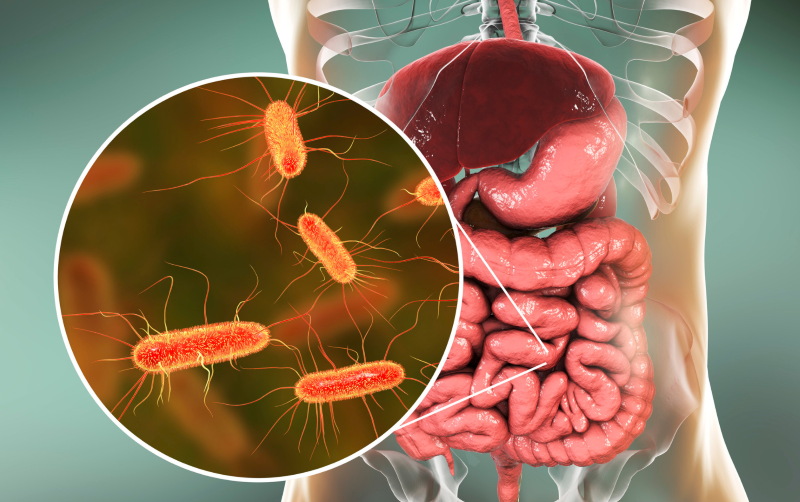 Small Intestinal Bacterial Overgrowth