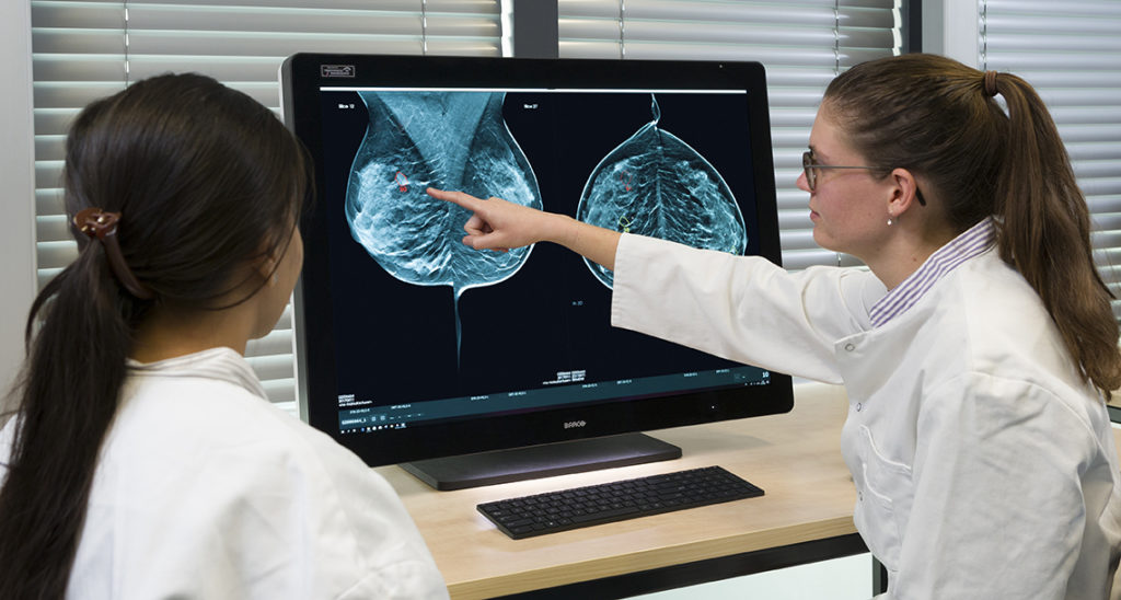 Breast Screening in Aberdeen