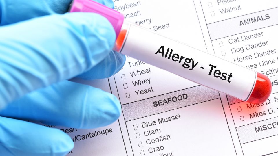 Allergies and Intolerances