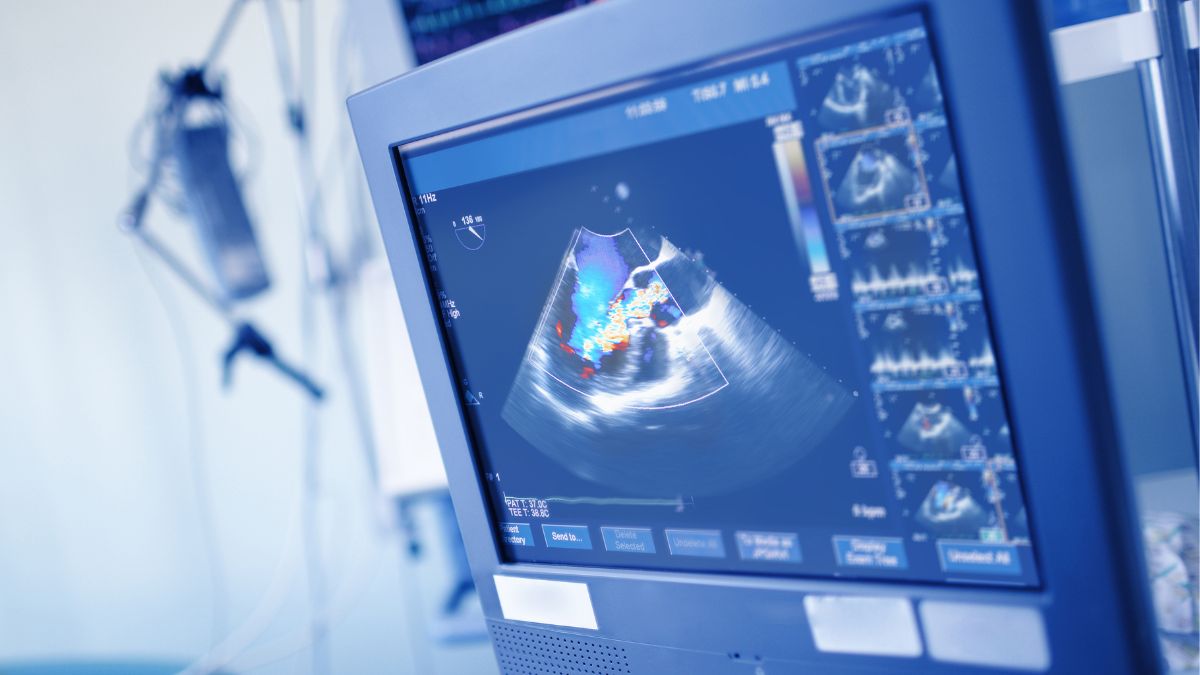 Cardiac investigations - Echocardiography