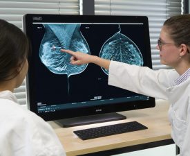 SPM-mamografie-0027-1-1024x548