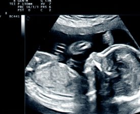 ultrasound-scan-baby_103577-2523